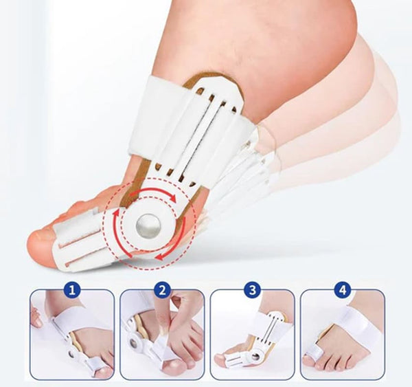 Tala OrtoFlex Ajustável para Joanete – Alívio Imediato e Correção Natural (Par) - Zen