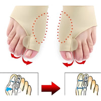 Par De Meias Corretor Ortopédico Joanete